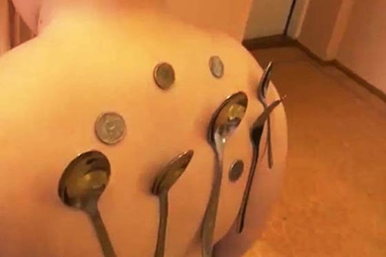 فيديو وصور.. طفل يتحول الى مغناطيس بعد اصابته بصعقة كهربائية صورة رقم 3