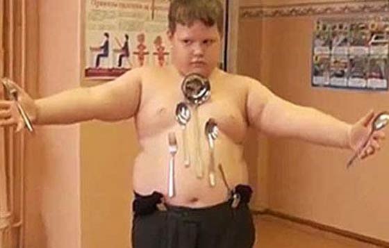 فيديو وصور.. طفل يتحول الى مغناطيس بعد اصابته بصعقة كهربائية صورة رقم 1