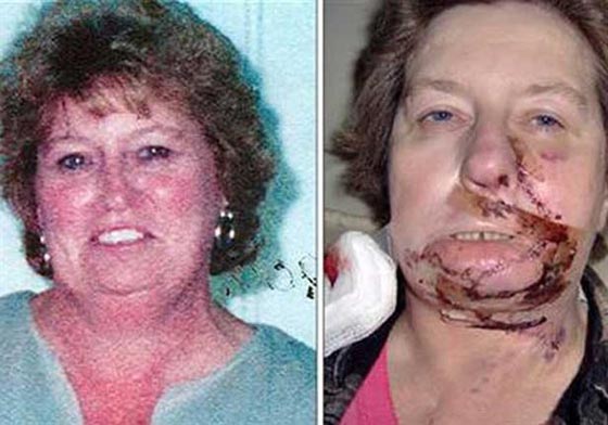 7 احداث غريبة وقعت داخل غرف العمليات عزف على الكمان ورسم على الوجه صورة رقم 2