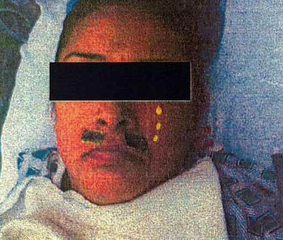 7 احداث غريبة وقعت داخل غرف العمليات عزف على الكمان ورسم على الوجه صورة رقم 3