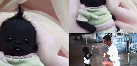 صور مثيرة للطفل صاحب اغمق بشرة في العالم.. عيناه بلا بياض صورة رقم 3