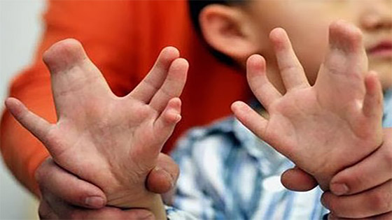 قصص وحكايات عن مخلوقات عجائبية.. بينها قصة شاب ولد بثلاثة ارجل صورة رقم 2