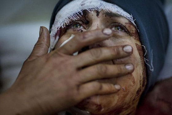 7 صور مأساوية نالت جوائز عالمية معظمها ناطقة بالعربية صورة رقم 4