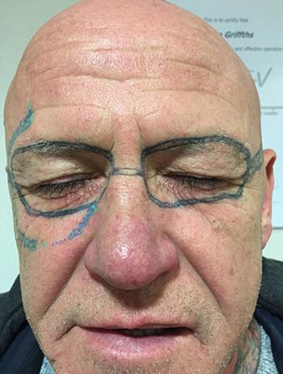 رجل ينام سكرانا ليفاجأ صباحا بوشم محرج على عرض وجهه صورة رقم 3