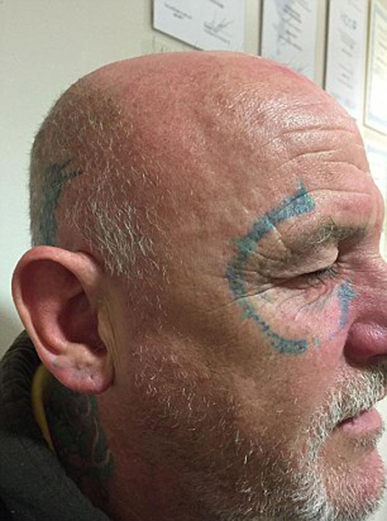 رجل ينام سكرانا ليفاجأ صباحا بوشم محرج على عرض وجهه صورة رقم 4