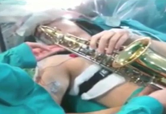 فيديو مثير.. رجل يعزف الساكسفون اثناء خضوعه لعملية في الدماغ صورة رقم 2
