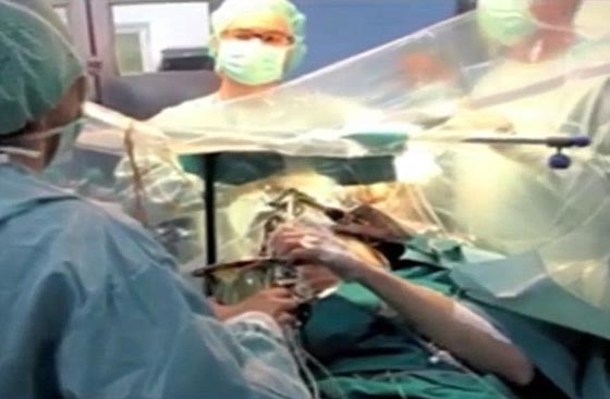فيديو مثير.. رجل يعزف الساكسفون اثناء خضوعه لعملية في الدماغ صورة رقم 5