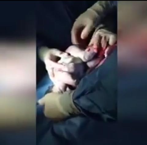 فيديو مثير.. لحظة خروج مولود من كيسه الامنيوسي صورة رقم 3