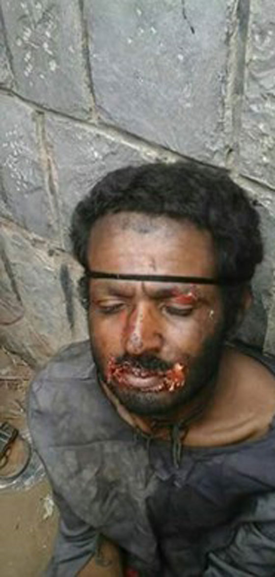  القبض على مصاص دماء الحيوانت في اليمن.. صور صورة رقم 1