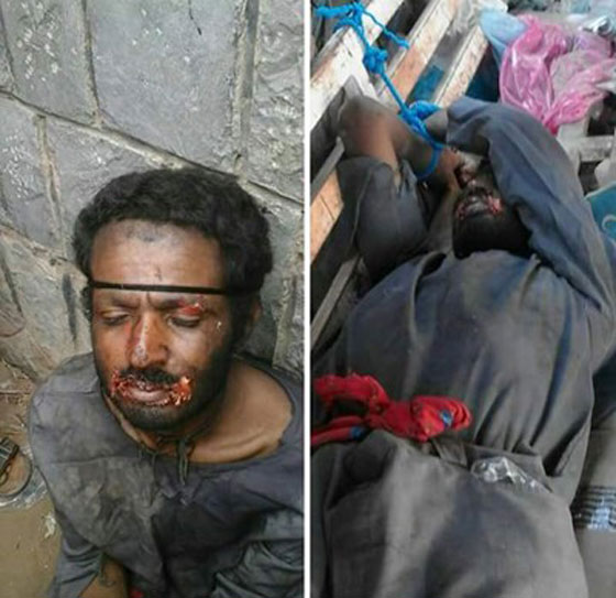  القبض على مصاص دماء الحيوانت في اليمن.. صور صورة رقم 3