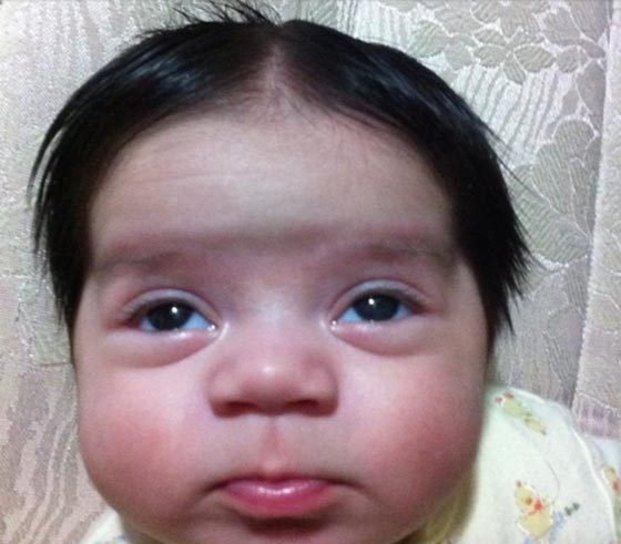 صور مضحكة لاطفال ولدوا بشعر كثيف.. ضمن حالات نادرة صورة رقم 15