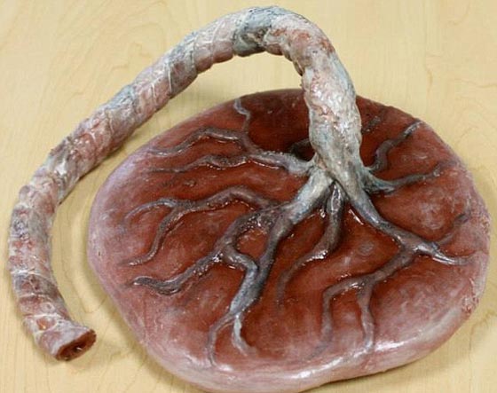 ممرضة تستوحي صناعة الكعك من غرفة العمليات والمشاهد المروعة صورة رقم 9