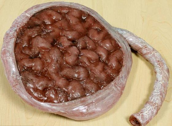 ممرضة تستوحي صناعة الكعك من غرفة العمليات والمشاهد المروعة صورة رقم 10