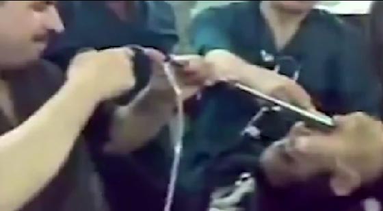 شاهد كيف اخرج اطباء عراقيون مفتاحا من بلعوم رجل.. لحظة اثر لحظة صورة رقم 1 شاهد كيف اخرج اطباء عراقيون مفتاحا من بلعوم رجل.. لحظة اثر لحظة صورة رقم 1
