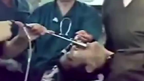 شاهد كيف اخرج اطباء عراقيون مفتاحا من بلعوم رجل.. لحظة اثر لحظة صورة رقم 2 شاهد كيف اخرج اطباء عراقيون مفتاحا من بلعوم رجل.. لحظة اثر لحظة صورة رقم 2