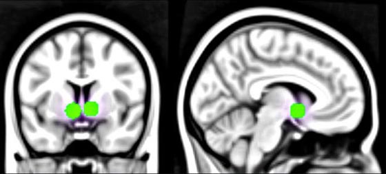 هكذا تحفز وسائل التواصل الاجتماعي ادمغة المراهقين على الرضا صورة رقم 3