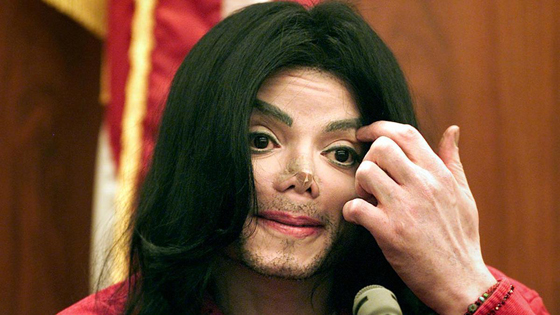 صورة رقم 2 - أسرار صادمة كشفها تقرير تشريح ملك البوب مايكل جاكسون.. ما هي؟ صورة رقم 2 - أسرار صادمة كشفها تقرير تشريح ملك البوب مايكل جاكسون.. ما هي؟