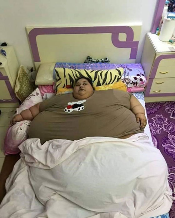  صور مؤلمة: مصرية وزنها 500 كغم  لم تخرج من بيتها منذ 25 عاما! صورة رقم 3