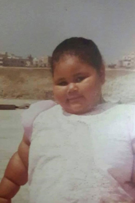  صور مؤلمة: مصرية وزنها 500 كغم  لم تخرج من بيتها منذ 25 عاما! صورة رقم 1