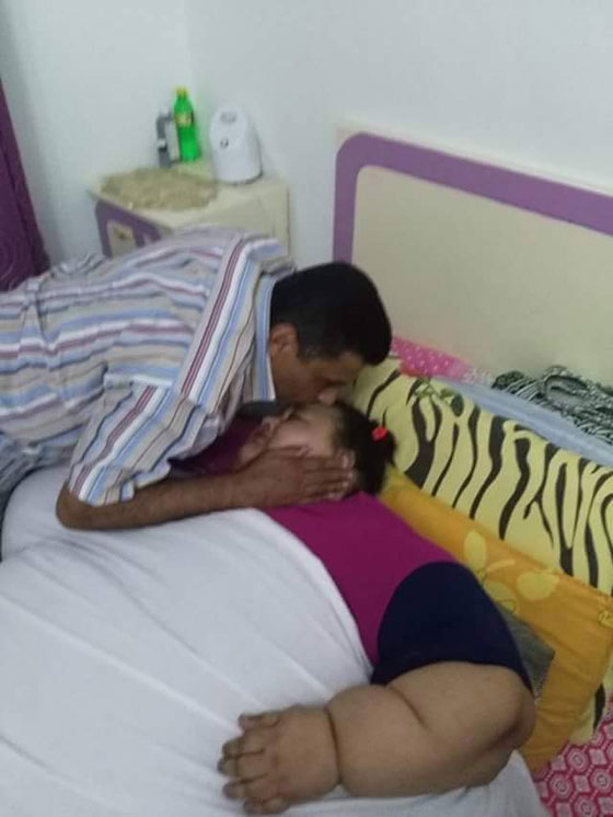  صور مؤلمة: مصرية وزنها 500 كغم  لم تخرج من بيتها منذ 25 عاما! صورة رقم 2