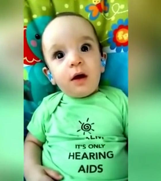 شاهد رد فعل طفل اصم يسمع صوت امه لاول مرة في حياته صورة رقم 2