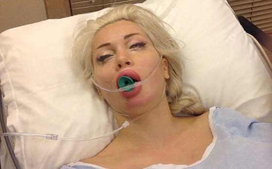 اجرت 100 عملية تجميل بينها ازالة اضلاع لتتشبه بشخصيات الكرتون صورة رقم 7