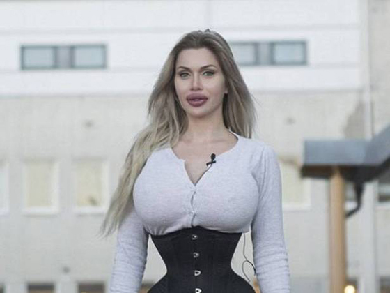 اجرت 100 عملية تجميل بينها ازالة اضلاع لتتشبه بشخصيات الكرتون صورة رقم 13
