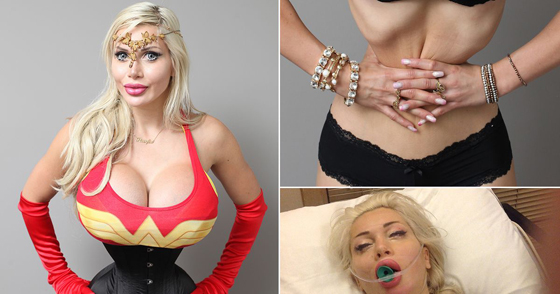 اجرت 100 عملية تجميل بينها ازالة اضلاع لتتشبه بشخصيات الكرتون صورة رقم 8