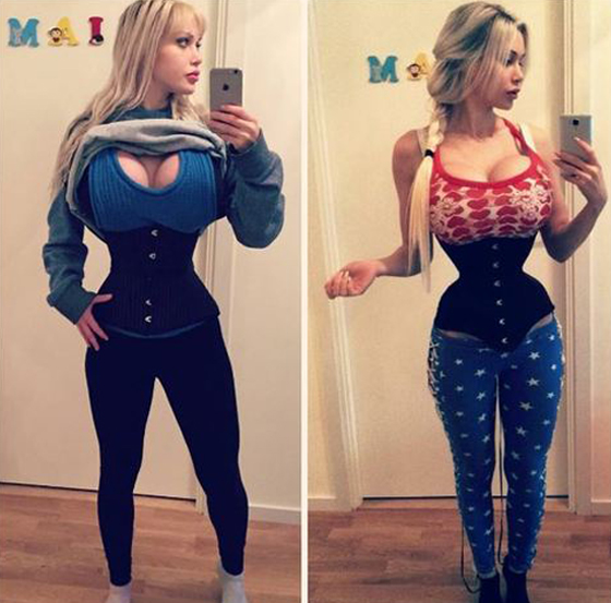 اجرت 100 عملية تجميل بينها ازالة اضلاع لتتشبه بشخصيات الكرتون صورة رقم 17