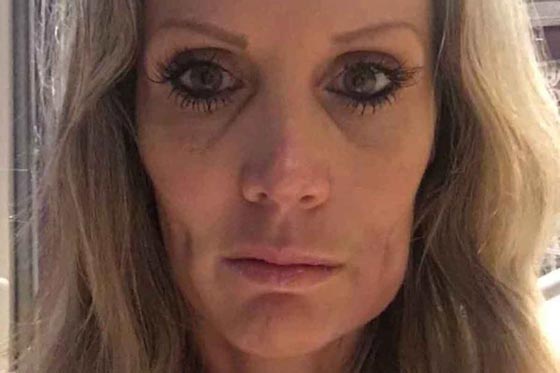 جنون ام.. غارت من غمازات ابنها فأجرت عملية تجميل لـ (خرم خديها)! صورة رقم 1 جنون ام.. غارت من غمازات ابنها فأجرت عملية تجميل لـ (خرم خديها)! صورة رقم 1