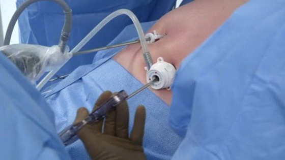 جهاز مغناطيسي للعمليات الجراحية يقلل من الالم ويسرّع الشفاء صورة رقم 4