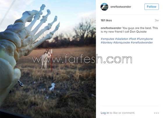 فتاة تعرض عظام ساقها المبتورة في كل مكان وتنشرها على انستغرام صورة رقم 29