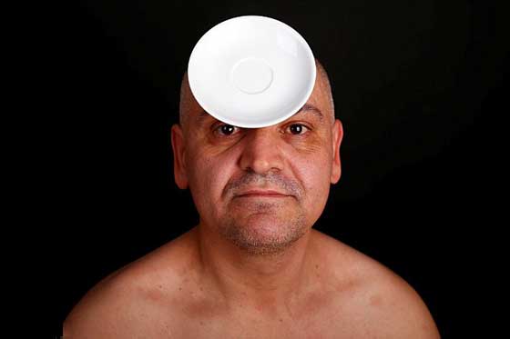 صور غريبة.. شخص يمتلك قدرات غريبة تجعل جسمه يجتذب المعادن كمغناطيس! صورة رقم 8 صور غريبة.. شخص يمتلك قدرات غريبة تجعل جسمه يجتذب المعادن كمغناطيس! صورة رقم 8