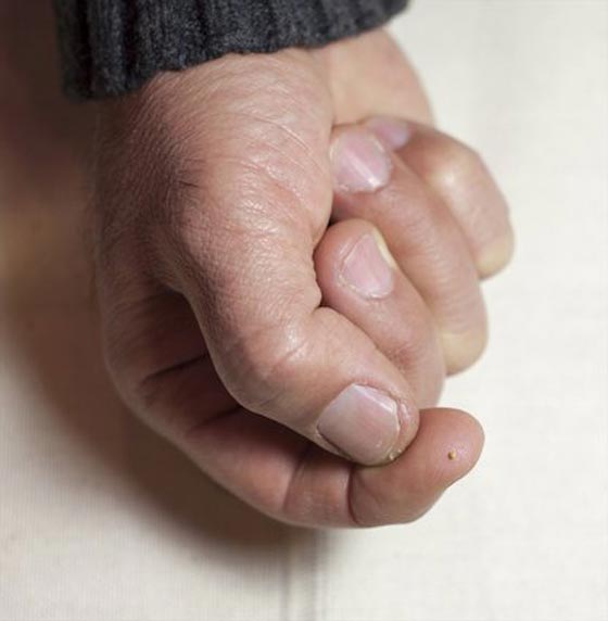 فنان مجهري تركي يخط 25 لوحة على نصف حبات من العدس! صور مدهشة صورة رقم 4 فنان مجهري تركي يخط 25 لوحة على نصف حبات من العدس! صور مدهشة صورة رقم 4