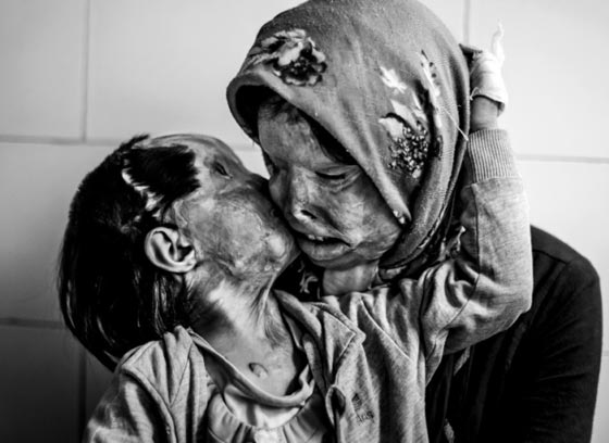  صور مؤثرة جدا تعكس لحظات الفرح والحزن، توحّد القلوب وتلمس المشاعر  صورة رقم 7