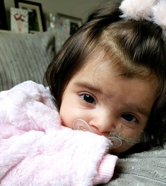   الطفلة بيلا ذات الشعر الكثيف والحجم الضئيل.. الناس يظنونها دمية او ترتدي باروكة ! صورة رقم 2