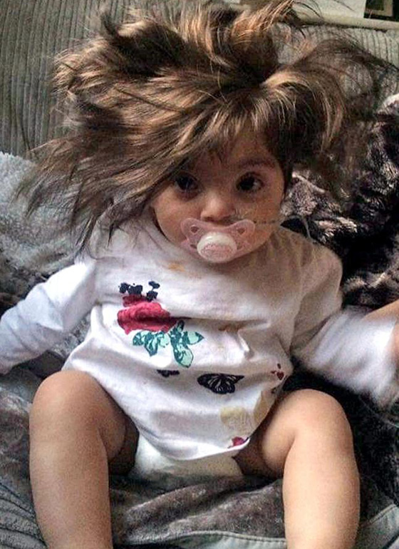   الطفلة بيلا ذات الشعر الكثيف والحجم الضئيل.. الناس يظنونها دمية او ترتدي باروكة ! صورة رقم 6