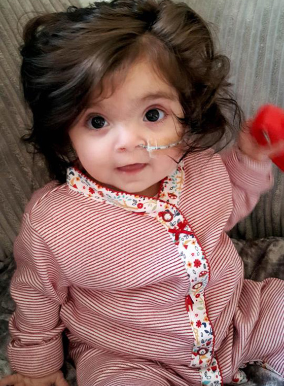   الطفلة بيلا ذات الشعر الكثيف والحجم الضئيل.. الناس يظنونها دمية او ترتدي باروكة ! صورة رقم 1