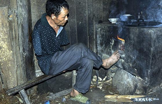 صورة ادهشت الملايين.. مبتور الذراعين يطعم والدته المريضة بفمه صورة رقم 6