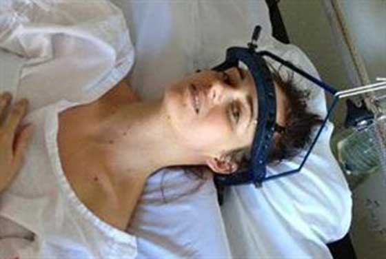 حالة غريبة امرأة تتعرض لكسر في الرقبة كلما عطست!! صورة رقم 6