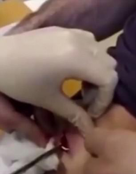 فيديو اغرب عرض زواج: رجل يفاجئ حبيبته الممرضة التي تعالجه بخاتم مخفي في جرح بمعدته! صورة رقم 4