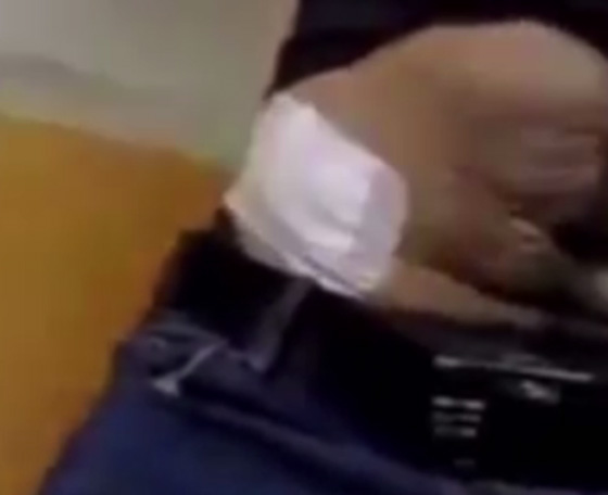 فيديو اغرب عرض زواج: رجل يفاجئ حبيبته الممرضة التي تعالجه بخاتم مخفي في جرح بمعدته! صورة رقم 1