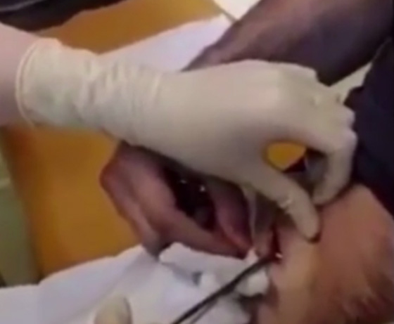 فيديو اغرب عرض زواج: رجل يفاجئ حبيبته الممرضة التي تعالجه بخاتم مخفي في جرح بمعدته! صورة رقم 3