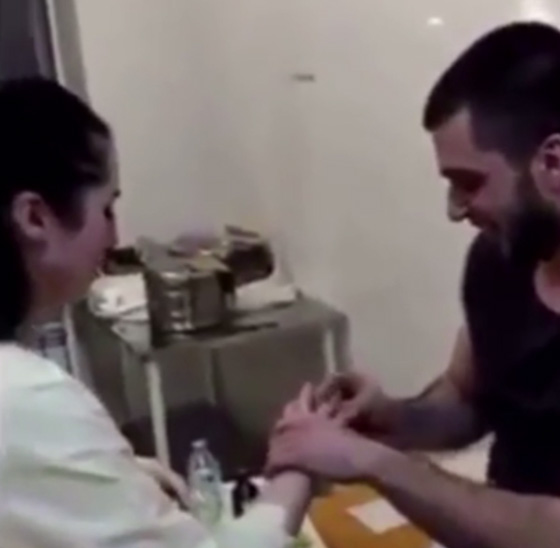 فيديو اغرب عرض زواج: رجل يفاجئ حبيبته الممرضة التي تعالجه بخاتم مخفي في جرح بمعدته! صورة رقم 6
