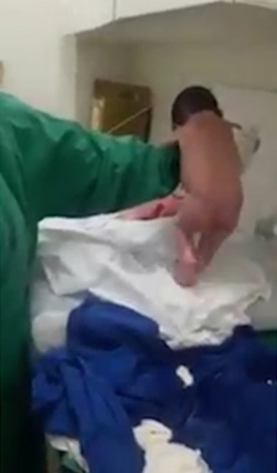 فيديو مذهل: رضيعة معجزة تمشي 10 خطوات بعد دقائق من ولادتها! صورة رقم 2