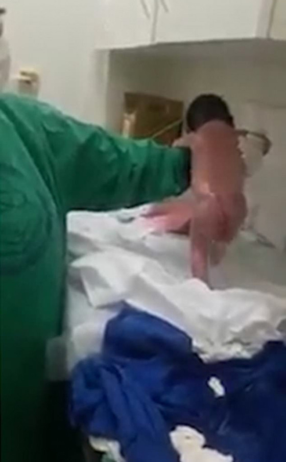 فيديو مذهل: رضيعة معجزة تمشي 10 خطوات بعد دقائق من ولادتها! صورة رقم 3