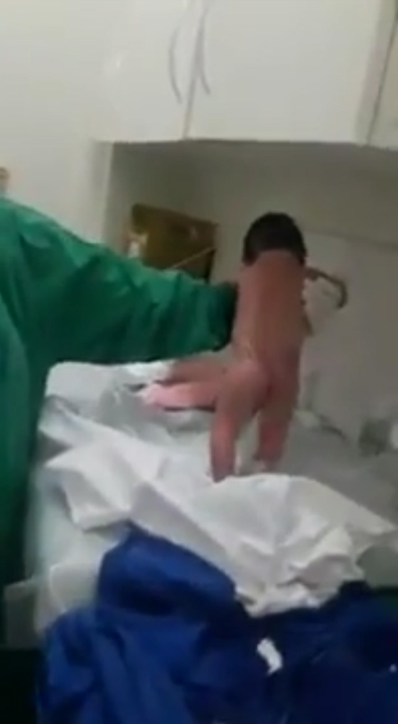 فيديو مذهل: رضيعة معجزة تمشي 10 خطوات بعد دقائق من ولادتها! صورة رقم 7