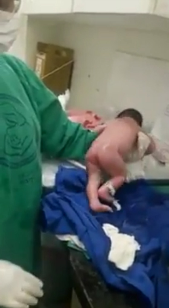 فيديو مذهل: رضيعة معجزة تمشي 10 خطوات بعد دقائق من ولادتها! صورة رقم 8