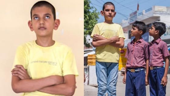 تعرف على 5 اطفال غير عاديين انعم الله عليهم بميزات نادرة.. فيديو مذهل صورة رقم 4