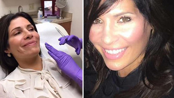 شاهدوا ما فعلته سيدة أمريكية لتصبح أجمل من ميلانيا ترامب.. فيديو صورة رقم 7